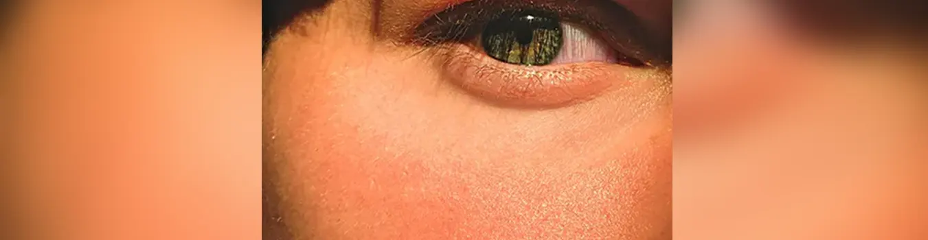 Tsikeloudi Blog - Skin boosters: ένα δώρο λάμψης και περιποίησης για το Πάσχα