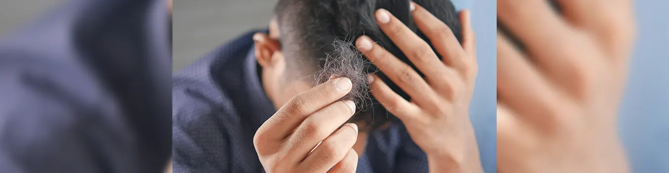 hair loss